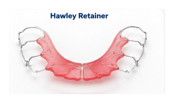 Hawley retainer displayed in a clean case